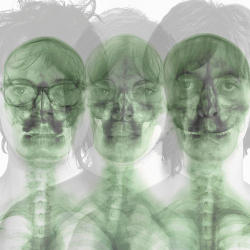 Cover: Supergrass - Supergrass (Remasterd Deluxe Edition) (2022) : Supergrass - Supergrass (Remasterd Deluxe Edition) (2022)